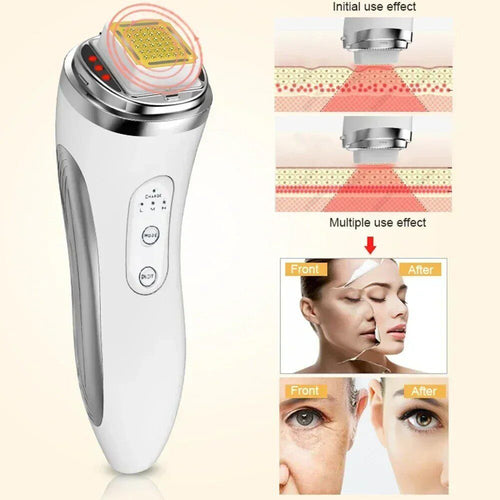 Dot Matrix Laser Device